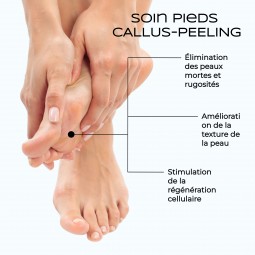 Beauté des pieds "callosités" (avec calluspelling)